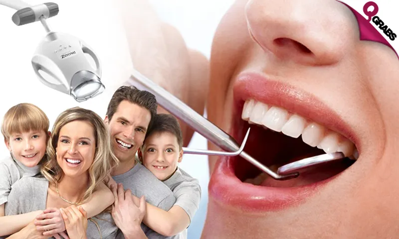 From QR150 Get a Million Dollar Smile with Teeth Scaling & Polishing OR Ortho Assessment OR Philips ZOOM Technology Teeth Whitening OR Hollywood Smile with Teeth Veneer! (Up to QR2200)